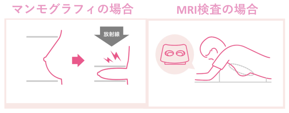うつ伏せで行う無痛MRI乳がん検診